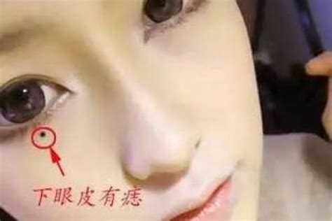 膝盖上长痣图解_膝盖上长了个痣好不好,第3张 膝盖上长痣图解_膝盖上长了个痣好不好,第3张